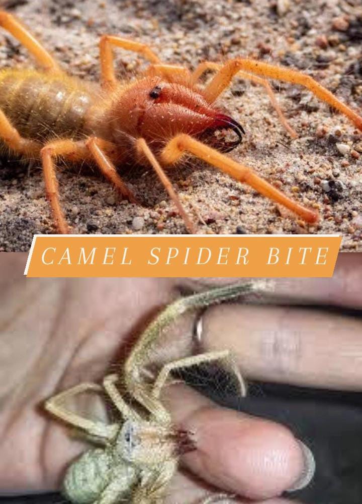 How Dangerous is a Camel Spider Bite?