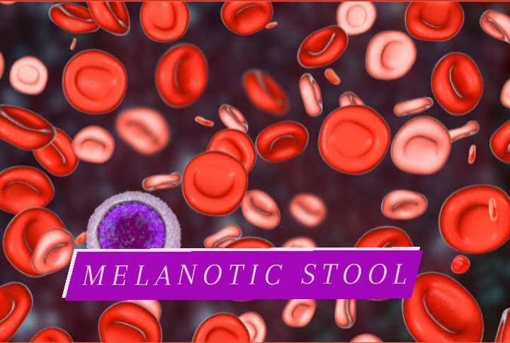 Melanotic stool – Causes – Treatment – Prevention